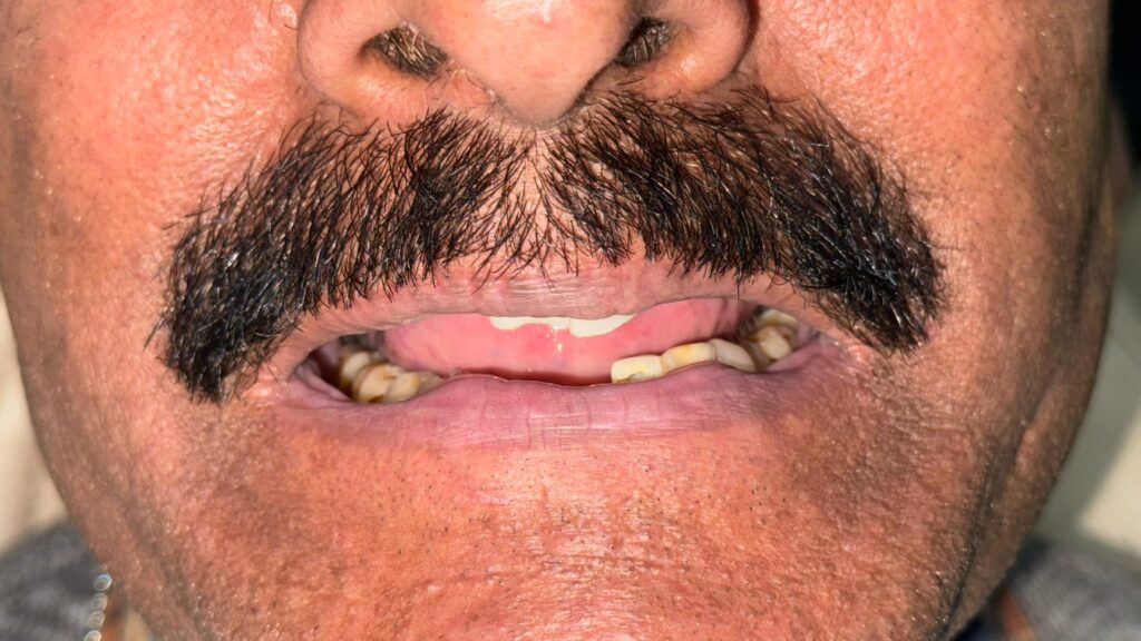 Before
