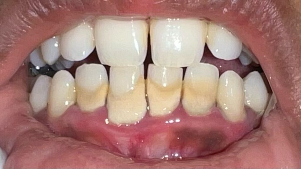 Before